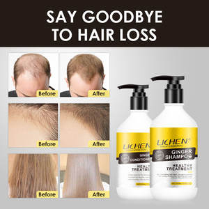 Lichen-champú y acondicionador <span class=keywords><strong>para</strong></span> el crecimiento <span class=keywords><strong>del</strong></span> <span class=keywords><strong>cabello</strong></span>, marca privada, anticaída de <span class=keywords><strong>cabello</strong></span>, jengibre - Product Image 5