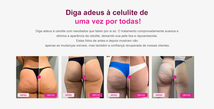<span class=keywords><strong>Crema</strong></span> Intensiva Multifuncional para el Cuerpo, <span class=keywords><strong>Crema</strong></span> para Estrías Rosadas con Árnica, Jengibre, Cafeína <span class=keywords><strong>y</strong></span> Té Verde para una Piel Suave <span class=keywords><strong>y</strong></span> Elástica - Product Image 5
