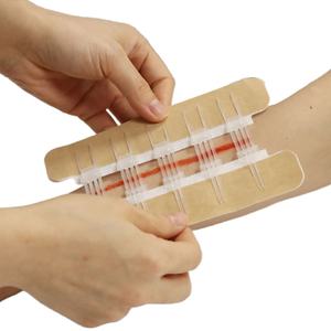 Dispositif de Fermeture de Plaie Stérile Couleur Peau de Haute Qualité, Très Vendu, pour Premiers Secours et Soins des Plaies - Zip Stitch - Product Image 3