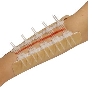 Dispositif de Fermeture de Plaie Stérile Couleur Peau de Haute Qualité, Très Vendu, pour Premiers Secours et Soins des Plaies - Zip Stitch - Product Image 1