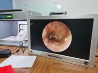 Système d'endoscopie vétérinaire portable OEM avec moniteur intégré pour utilisation avec une sonde rigide, endoscope vétérinaire 1080P