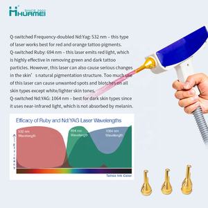 הזדמנויות עסקיות מפיץ המחיר הטוב ביותר הסיטונאי q החליף לייזר הסרת קעקוע - Product Image 4