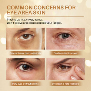 OEM Retinol Kafein Göz Çevresi Bakım Stick'i Sıkılaştırır, İnce Çizgileri Düzleştirir, Şişlikleri Azaltır, Nazik, Tahriş Etmeyen Göz Kremi Stick'i - Product Image 5