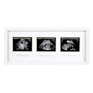 Marco De Fotos Blanco Grande – Para 10 Fotos, Diseño Moderno, Plástico, Medidas 37x72 Cm, Ideal Para Recuerdos Familiares