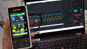 Monitor de Signos Vitales Multiparamétrico Médico RN100S con Spo2, Nibp, Temperatura y Etco2 Opcional de Flujo Principal o Lateral - Product Image 6
