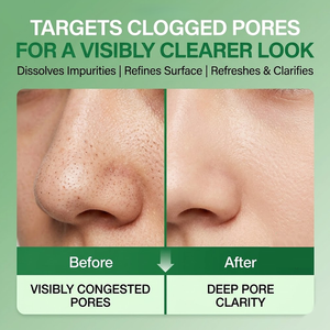 Gel Limpiador Profundo de Poros con Quercetinol y BHA, Limpiador Facial con Ácido Salicílico, Eliminación de Puntos Negros, Ácido Hialurónico, Doble Limpieza a Base de Plantas - Product Image 5