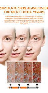 Analyseur de <span class=keywords><strong>peau</strong></span> facial intelligent à IA avec écran tactile pour l'analyse des pores et des pigments, rapport d'analyse d'image 3D de premier <span class=keywords><strong>choix</strong></span> - Product Image 6