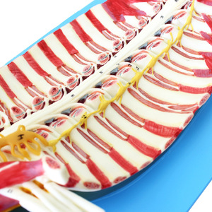 Anatomiemodel Van Het Menselijk Wervelkanaal Met Zenuwen In Het Ruggenmerg-Voor Anesthesie En Minimaal Invasieve Lumbaal Onderwijs - Product Image 2