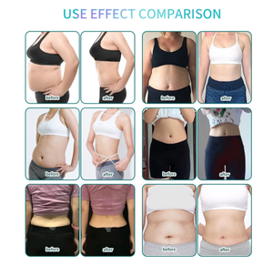 Equipo de Belleza de Última Generación, Masajeador de Fitness con Estimulación Muscular, Mejora la Circulación Sanguínea, Reduce la Grasa Facial y del Cuello - Product Image 6