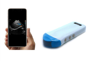 192 Element Konted C10RS Neue tragbare Ultraschall-Konvex-<span class=keywords><strong>Scanner</strong></span>-Sonde für tragbare Mobiltelefone - Product Image 4