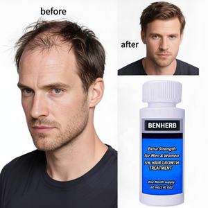 Logo personnalisé 5% Kirland naturel organique croissance des cheveux cuir chevelu biotine huile de traitement en profondeur pour hommes nourrissant rapide croissance des cheveux - Product Image 3