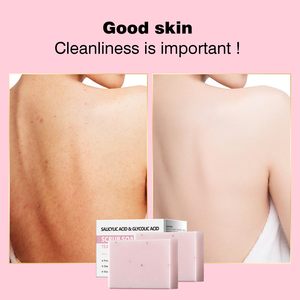 Barra de jabón de baño de limpieza profunda Facial saludable Jabón exfoliante de ácido salicílico antiimperfecciones <span class=keywords><strong>para</strong></span> pieles sensibles - Product Image 3