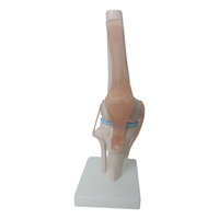 Science médicale arthrose anatomie pathologique PVC artificiel flexible taille réelle squelette humain modèle anatomique de l'articulation du genou