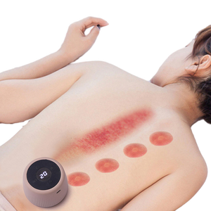 Productos de Tendencia 2026: Masajeador Inteligente de Terapia de Ventosas Hijama, Kit de Ventosas Eléctricas Chinas al Vacío con 6 Copas - Product Image 1