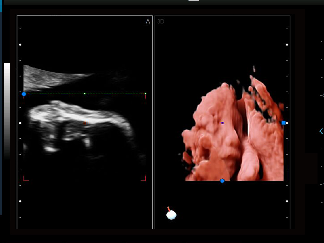 GH-F5pro3D Home Fetal Ultrasound Machine Echographe Equipment For Obsteristic Gynecology