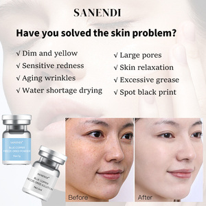 Wholesale Blue Copper Peptide <b>Serum</b> Moisturizing Smoothing Facial Essence Custom Logo Skin Care OEM ODM - Product Image 5