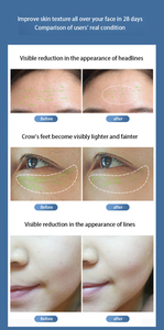 2026 bureau gouttelettes d'eau Lifter I-Cool Machine peau serrant le visage Lifting Machine de beauté pour salon de beauté - Product Image 6