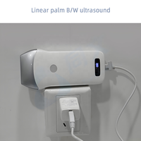 Sonde d'échographie sans fil 3-en-1 avec modes convexe/linéaire/transvaginal pour usage humain et vétérinaire – Scanner d'échographie sans fil