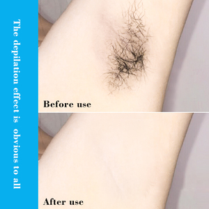 <span class=keywords><strong>Mousse</strong></span> <span class=keywords><strong>dépilatoire</strong></span> bio à base de plantes de haute qualité, crème, lotion, spray naturel pour hommes, épilation corporelle - Product Image 6