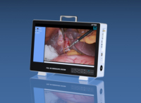 Système de caméra d'endoscopie portable Full HD IKEDA avec moniteur LCD 22 pouces pour utilisation en tour d'endoscopie ORL et laparoscopie