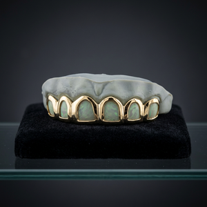 Grillz personnalisés à 6 dents, en or jaune et argent, avec pierres, pour hommes et femmes, en or massif 14K et moissanite, bijoux de piercing de qualité supérieure, style hip-hop - Product Image 3