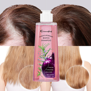 Champú OEM/ODM de Cebolla y Romero con Biotina, Hidratante para el Crecimiento del Cabello, Cuidado para Cabello Seco, Champú Refrescante para Cabello Fino, de Fábrica - Product Image 6