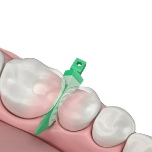 Cuñas dentales interdentales, cuñas compuestas de sellado, Material de dentista adaptable adecuado de silicona para restauración dental - Product Image 2
