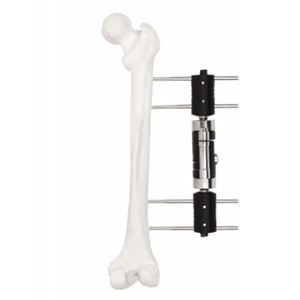 <span class=keywords><strong>Fixator</strong></span> eksternal dinamis Axial eksternal <span class=keywords><strong>Fixator</strong></span> sendi kaki tipe sistem fiksasi eksternal - Product Image 5