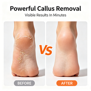 Gel exfoliant pour les pieds extra fort personnalisé à prix d'usine Fournitures de <span class=keywords><strong>pédicure</strong></span> à <span class=keywords><strong>domicile</strong></span> de qualité salon callosités dissolvant - Product Image 4