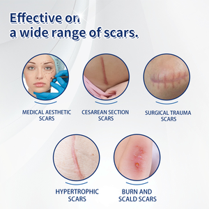 Láminas de Silicona Reutilizables de Grado Médico Huawell: Eficacia Clínica, Soluciones Personalizables y Producción a Gran Escala - Product Image 6