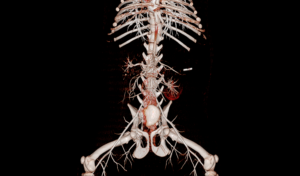 Équipement médical EURVET, système de tomodensitométrie numérique de diagnostic à 16, 24, 32, 64 coupes, scanner CT médical - Product Image 3