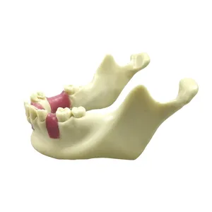 Modelo Dental de Práctica de Implantes, Modelo de Enseñanza de Dientes, Herramienta de Demostración para Entrenamiento Educativo, Modelo de Simulación de Hueso de Mandíbula Inferior - Product Image 6