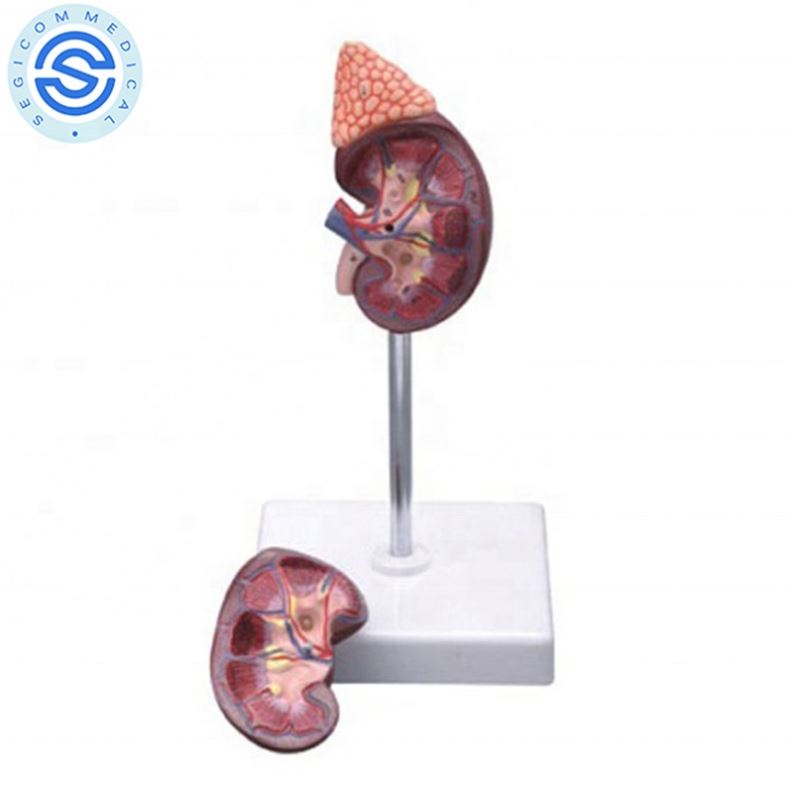 Заводская цена, почка с моделью надпочек, реалистичный внутренний орган, пищеварительная система, 2 части, обучение, распродажа