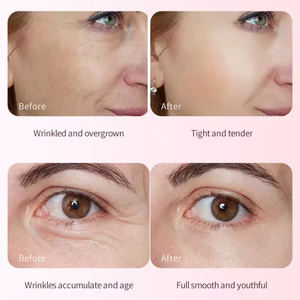 5-in-1 Hyaluronsäure Gesichtsserum GMP Aufhellende Hautpflege Kollagen Koreanisches Kollagenpeptid Dunkle Flecken Korrekturserum - Product Image 6