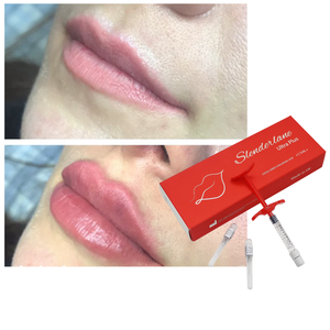 Meilleur <span class=keywords><strong>Prix</strong></span> – <span class=keywords><strong>Acide</strong></span> <span class=keywords><strong>Hyaluronique</strong></span> Injectable Certifié CE, Sans Effet Secondaire, pour Remplissage du <span class=keywords><strong>Nez</strong></span>, du Menton, du Visage, des Lignes de Rides et des Rides du Cou - Product Image 1