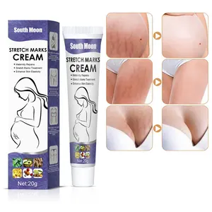 South Moon Hot Selling 100% Natuurlijke Postpartum Anti-Vergetures Voor Zwangere Vrouwen Beste Striae Verwijderen Crème