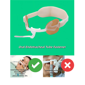 Support auto-adhésif pour tube endotrachéal, fixation pour bandage auto-adhésif ETT - Product Image 1
