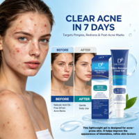 Crème-gel anti-acné en gros : cible les boutons, les rougeurs et les marques post-acnéiques
