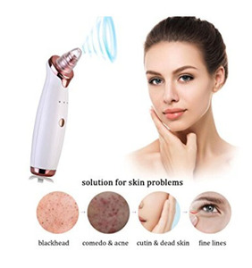 Extracteur de points noirs portable USB rechargeable, étanche, pour soins de <span class=keywords><strong>la</strong></span> peau, outil de beauté, <span class=keywords><strong>aspirateur</strong></span> à points noirs, nettoyeur de pores spa - Product Image 2