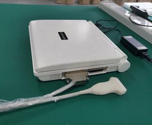 C55 ONETECH EASY DIAGNOSE farb-<span class=keywords><strong>doppler</strong></span> <span class=keywords><strong>2d</strong></span> 3d ultraschall tragbarer diagnostischer <span class=keywords><strong>scanner</strong></span> für krankenhäuser ultraschall - Product Image 6