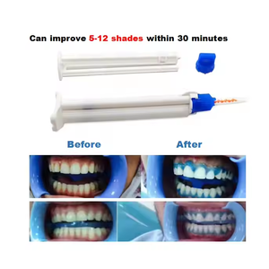 Aprobado por La CE 35% Peróxido <span class=keywords><strong>de</strong></span> hidrógeno Gel blanqueador <span class=keywords><strong>de</strong></span> dientes Jeringa <span class=keywords><strong>de</strong></span> doble barril OEM - Product Image 6