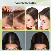 Semprotan penumbuh rambut Rosemary berbasis tanaman Label pribadi merek SNUKIA dengan minyak kamelia untuk mengurangi rambut rontok memperkuat akar