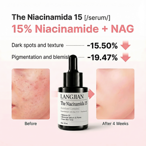 Suero Facial con 15% de Niacinamida al por Mayor, Cuidado de la Piel Coreano, Minimizador de Poros, Unifica el Tono de la Piel, Elimina Manchas Oscuras, Suero Antiarrugas - Product Image 5