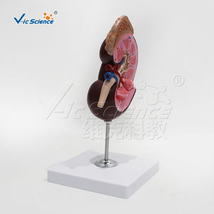 Model anatomi Ginjal manusia PVC dasar untuk pelatihan sains medis untuk sekolah dan rumah sakit - Product Image 4
