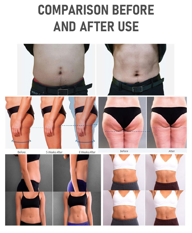 EMS electromagnético quemar grasa forma delgada músculo cuerpo ems máquina