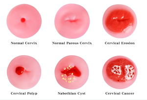 Modelo de Exhibición de Patología <span class=keywords><strong>Cervical</strong></span> Femenina para Ciencias Médicas, Niveles 1-6, Recursos Didácticos - Product Image 3