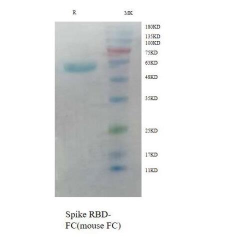 Эпидемический белок 2020 (субъединица S1, His Tag)