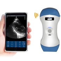 Sonde d'échographie sans fil 3-en-1 avec modes convexe/linéaire/transvaginal pour usage humain et vétérinaire – Scanner d'échographie sans fil