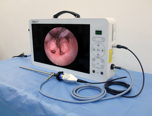 Sistema de Cámara de Endoscopio Rígido Integrado Médico de 17 Pulgadas Full HD con Grabador para Urología/ENT/artroscopia, Precio de Fábrica - Product Image 2