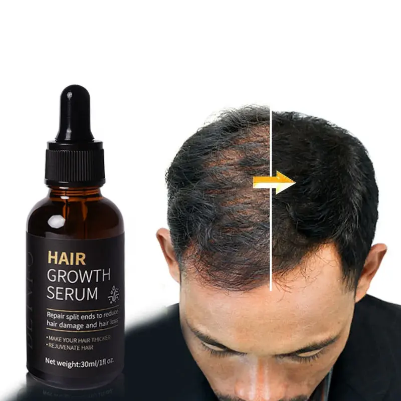 OEM 100% doğal formülü toptan biyotin saç büyüme Serum tedavisi saç büyüme yağı siyah kadınlar için özel etiket